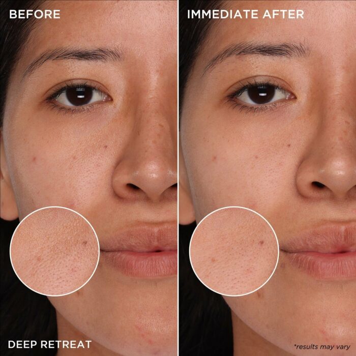 MADO Réunion | Porefessional Package Deal | Benefit