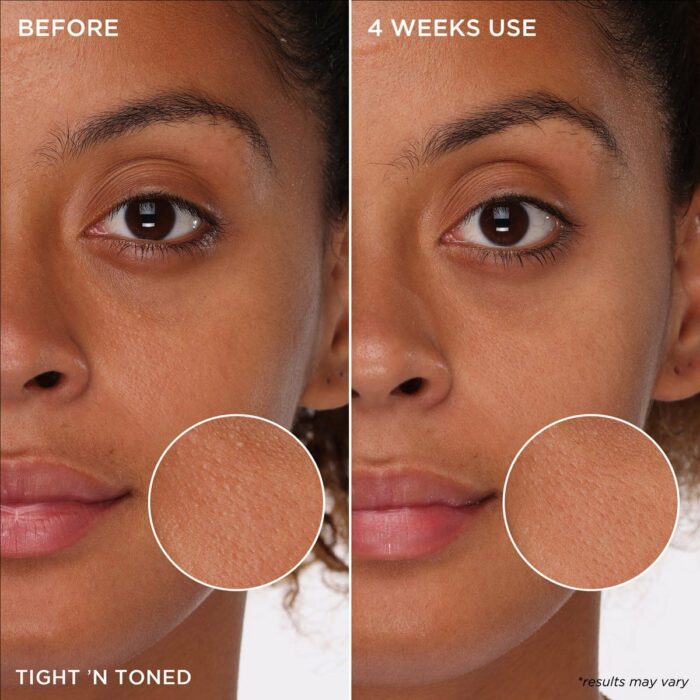 MADO Réunion | Porefessional Package Deal | Benefit